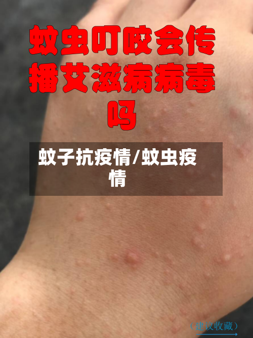 蚊子抗疫情/蚊虫疫情-第2张图片